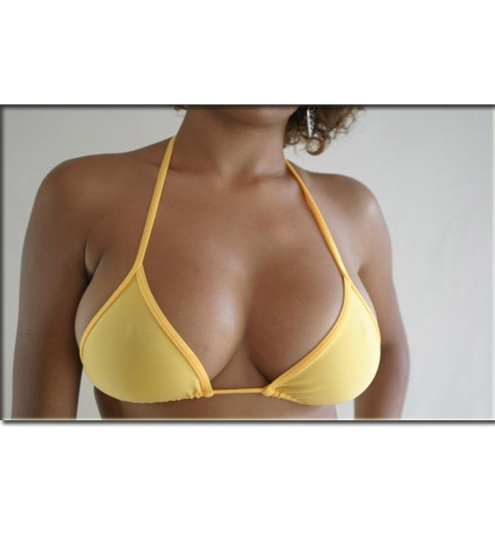 Brazilian Medium Bikini Top - Yellow